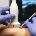Is fysiotherapie echt effectief?