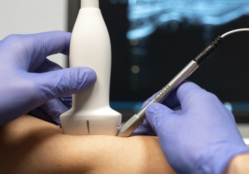 Is fysiotherapie echt effectief?